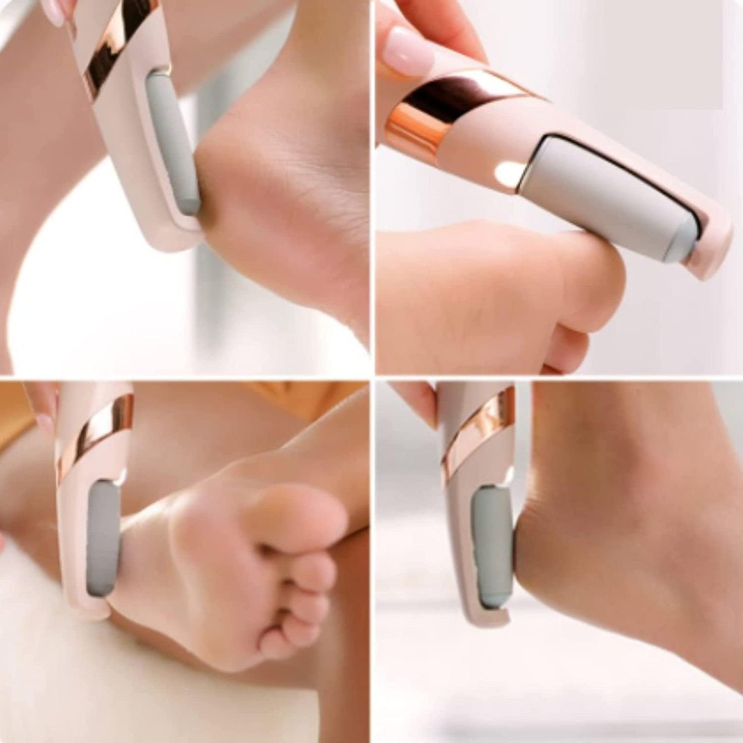 Dead Skin Remover I Callus Remover For Feet I Rechargeable Pedicure Tool