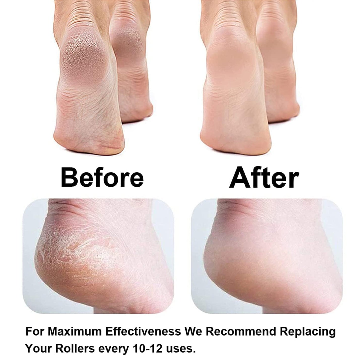 Dead Skin Remover I Callus Remover For Feet I Rechargeable Pedicure Tool
